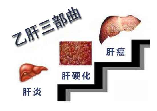 郑州治肝病好的医院有哪些