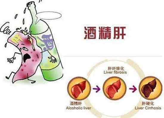 上海瑞金医院肝病教授亲临河南省医药院附属医院会诊,看肝病,教授更好