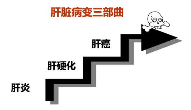 河南哪个肝硬化医院好?郑州哪个医院肝病科好