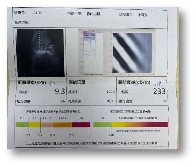 郑州肝病医院哪家好?河南治疗肝病那个医院好