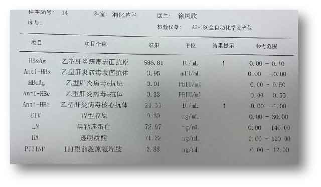 郑州肝病医院哪家好?河南治疗肝病那个医院好