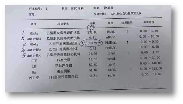 郑州肝病医院哪家好?河南治疗肝病那个医院好