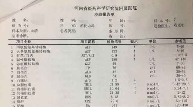 郑州那家医院看肝硬化好?河南好治疗肝硬化的医院